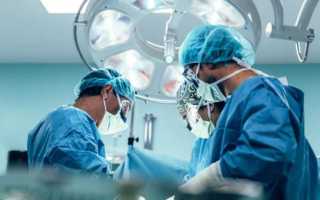 Опухоли почек и мочевого пузыря (рак мочевого пузыря лечение, опухоль мочевого пузыря операция)