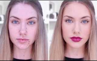 Почему на лице появляются родинки, и каковы последствия их удаления?