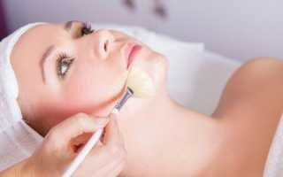 Гликолевый пилинг лица — отзывы и результаты с фото до и после