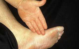 ЗАЛАИН крем: 19 отзывов от реальных людей. Все отзывы о препаратах на сайте