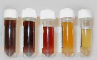 Темная Моча у Ребенка по Утрам: Причины и Лечение Заболевания