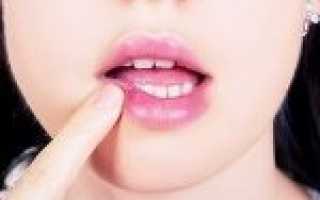 Герпес на губах у будущей мамы: чем угрожает, как лечить