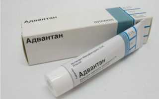 Правда и выдумки об экземе: кого она выбирает и как её лечить