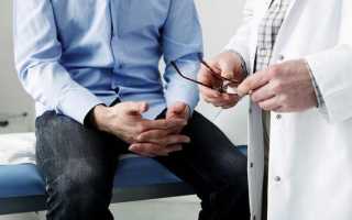 Какой врач лечит мочеполовую систему у мужчин. О чем молчат мужчины. Хронический инфекционный простатит