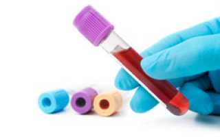 Креатинин норма в крови у мужчин по возрасту (таблица)