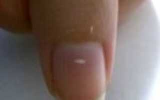 Белые пятна под ногтями: зачем они нужны, и что они могут рассказать о здоровье