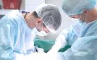 Удаление меланомы: виды операций, показания, противопоказания, последствия