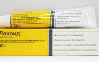 Выбираем эффективную мазь от экземы на лице, руках и ногах