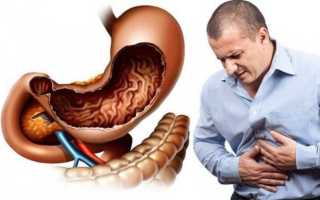 «Нет» прыщам на голове в волосах у мужчин и женщин: причины и лечение высыпаний