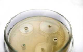 Чувствительность к антибиотикам в урологии