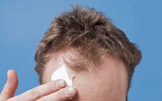 Особенности лечебного шампуня как средства от демодекоза