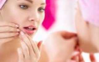 «Базирон АС»: отзывы дерматологов. «Базирон АС» (гель): инструкция по применению, описание и дешевые аналоги