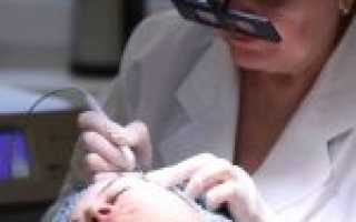 К какому врачу обращаться с бородавками и лечит ли дерматолог кожные наросты?