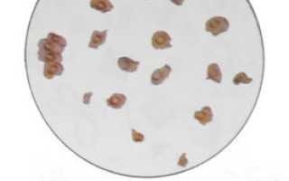 Эпителий Плоский В Моче У Ребенка: 3 Основных Вида, Норма