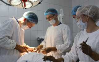 Киста яичка у мужчин — причины, симптомы и лечение. В чём заключается профилактика кисты яичка у мужчин — Женское мнение