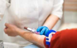 Причины возникновения зуда и жжения при кондиломах