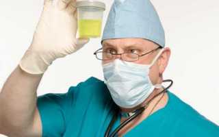 Анализ камней из почек — где сделать