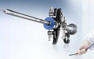 Урология, методы диагностики и лечения в урологии