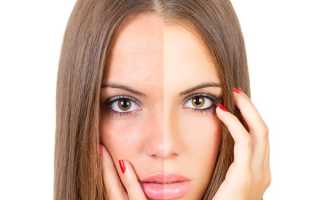 Маска корой дуба для лица. Отвар из коры дуба для лица. Лечебные свойства коры дуба.