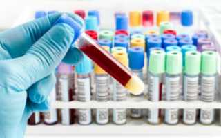 Мочевина в биохимическом анализе крови при почечной недостаточности животных