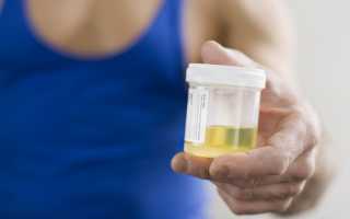 Эпителий плоский в моче при беременности повышен — Почки