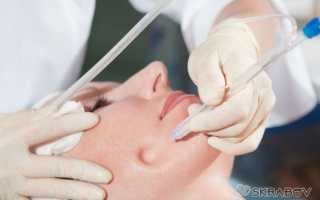 Как выдавить черные точки на носу: пошаговая инструкция