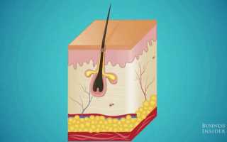 Что делать, если под глазами образовались милиумы (белые точки)?