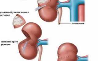 Стенд в урологии как он выглядит