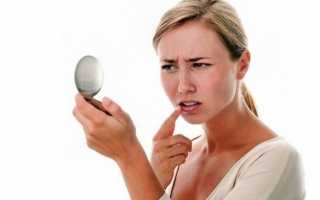 Сколько длится инкубационный период герпеса при разных типах вируса