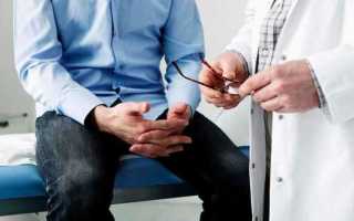 Противовоспалительные свечи при простатите: нпвс и натуральные компоненты