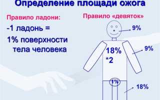 Что такое термический ожог: классификация, виды и признаки