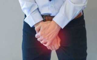 Боль в правом яичке: причины, симптомы, лечение