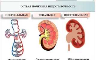 Лечение почечной недостаточности хронической формы, диализ