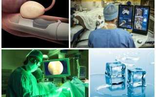 Урология операция тур последствия и отзывы