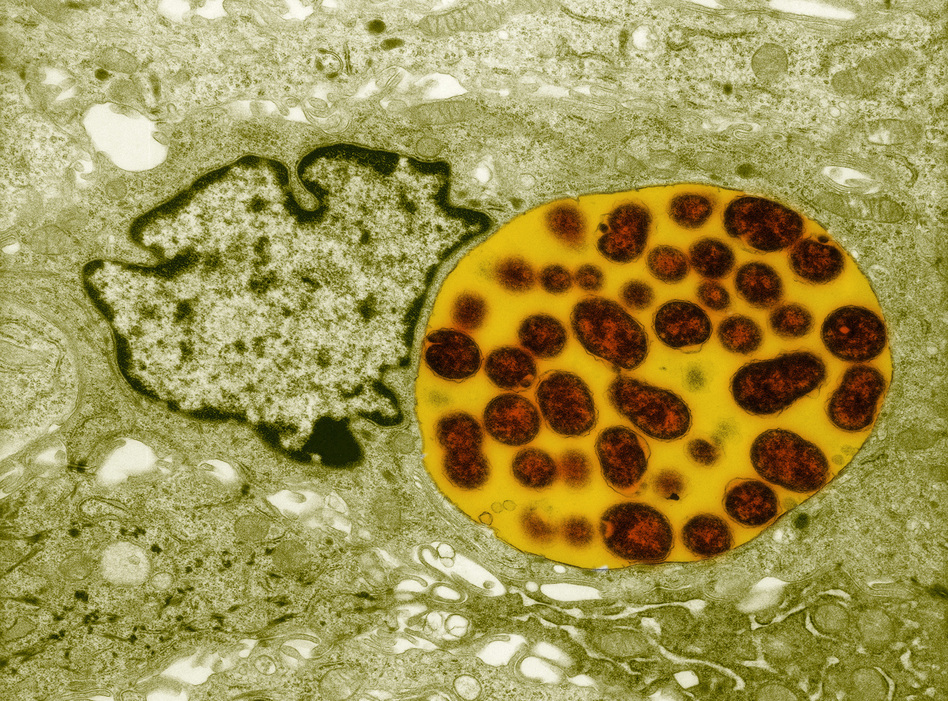 возбудитель хламидиоза хламидия