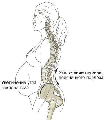 Болит спина и тазобедренный сустав при беременности