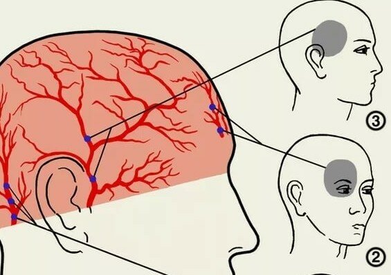 Постоянно болит голова болят глаза