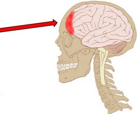 Если сильно болит лобная часть головы