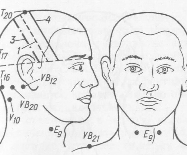 что может быть болит голова и давит на глаза