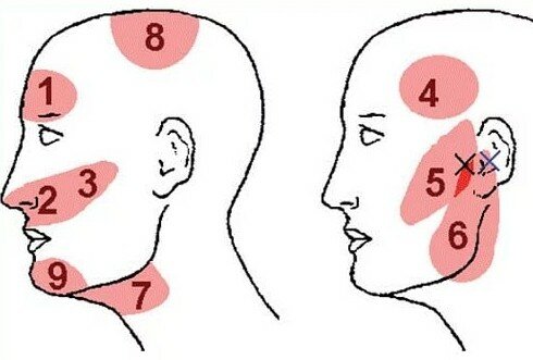 Болит голова в виске день