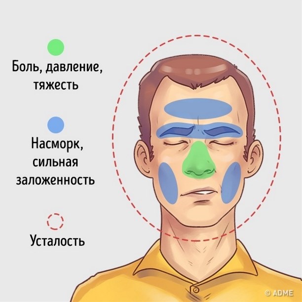 У меня голова безумно болит