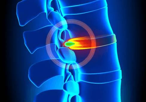 Очень болит спина в области лопаток и шеи