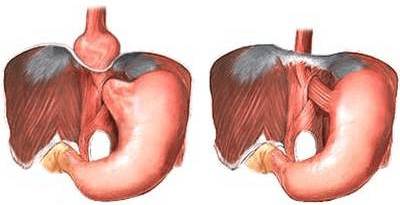 Почему болит спина в пояснице слева у женщин