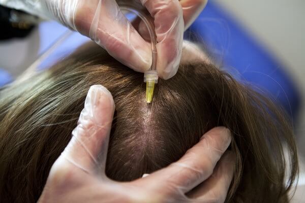 Болит кожа головы выпадают волосы жжение кожи головы