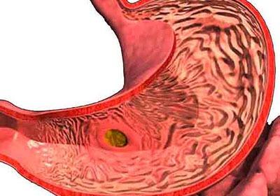 Почему болит спина в пояснице слева у женщин