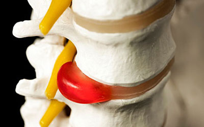 Боли в спине весь позвоночник болит ночью