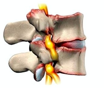 Почему болит спина в пояснице слева у женщин