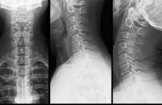 Почему болит спина выше поясницы и ниже лопаток справа