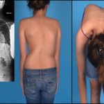 болит грудь и спина сзади